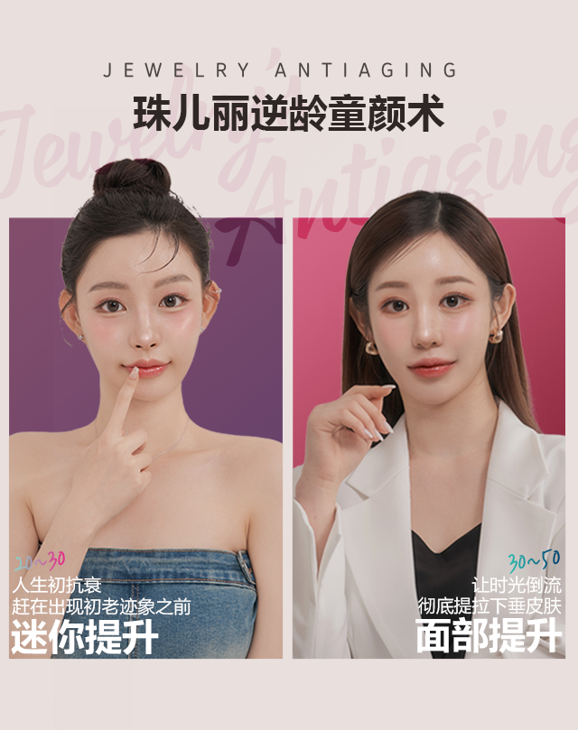 ��Ƽ����¡